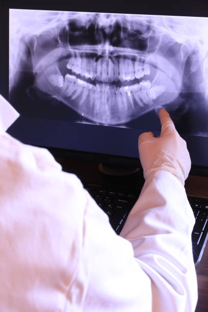 Best Same-Day Emergency Dentist in Wilderness Rim, WA