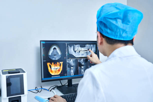 Best Emergency Broken Tooth Repair in Wilderness Rim, WA